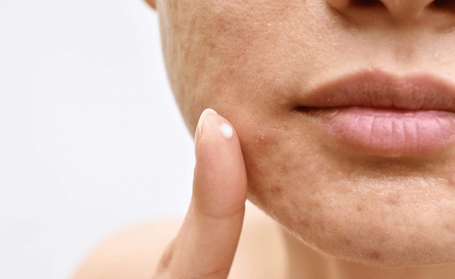 Notre sélection de crèmes et de produits contre les imperfections du visage