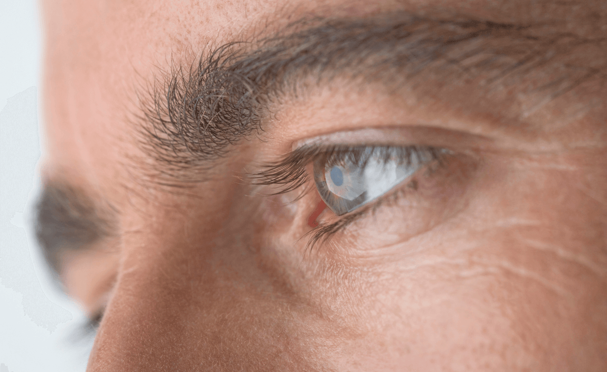 contour de l'oeil